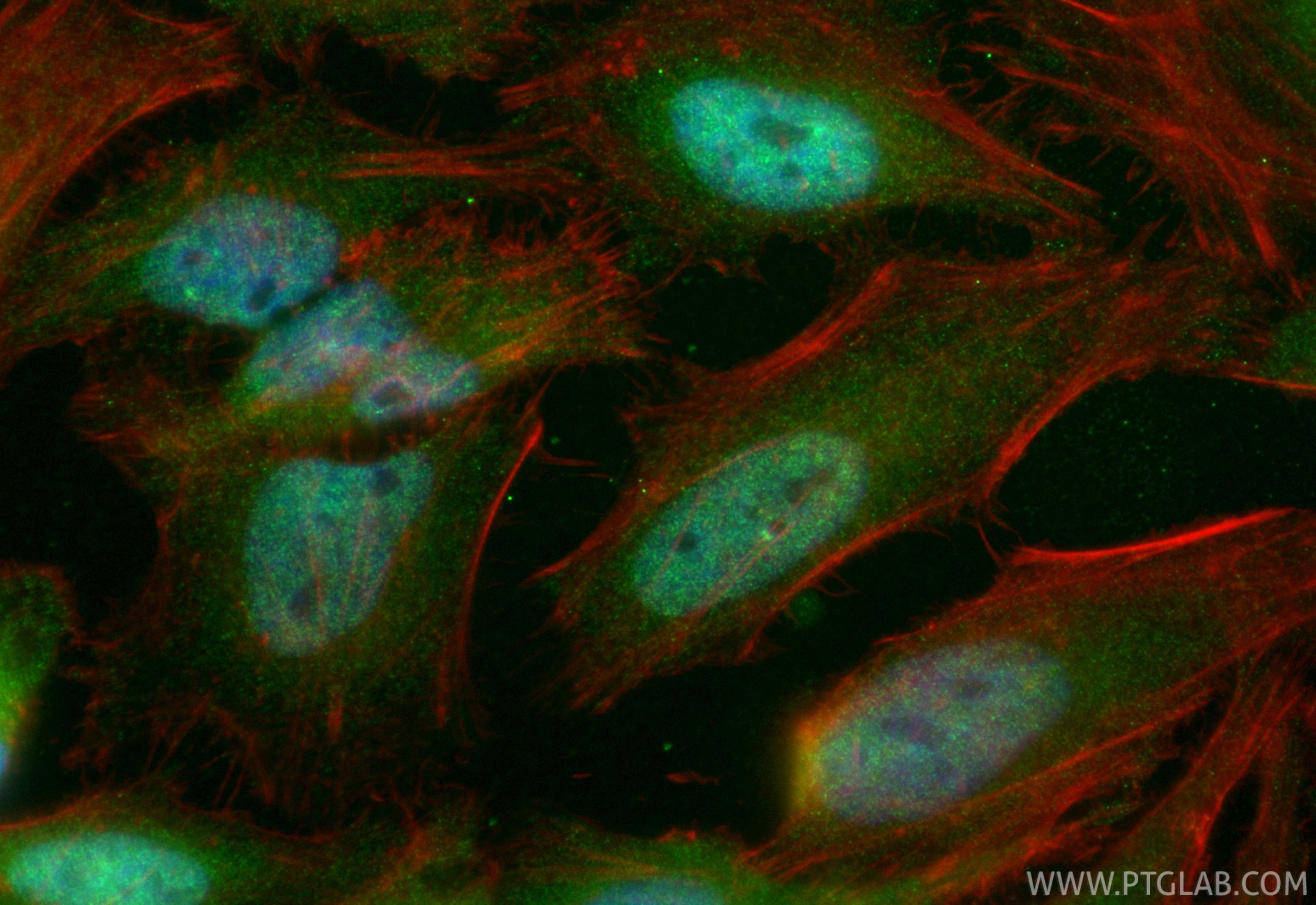 Immunofluorescent analysis of (4% PFA) fixed HeLa cells using CoraLite® Plus 488 REST antibody (CL488-84846-4, Clone: 241789D3 ) at dilution of 1:200, CL594-Phalloidin (red). Immunofluorescence (IF) / fluorescent staining of HeLa cells using CoraLite® Plus 488-conjugated REST Recombinant mon (CL488-84846-4)