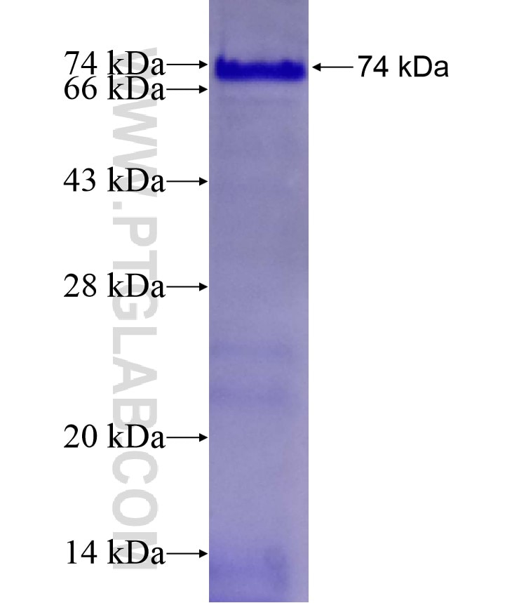 REST fusion protein Ag17707 SDS-PAGE