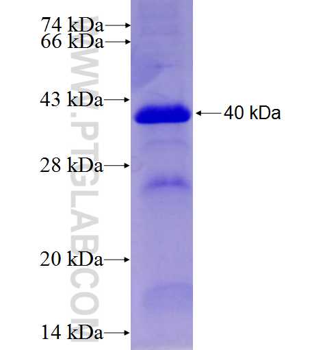 RET fusion protein Ag25584 SDS-PAGE