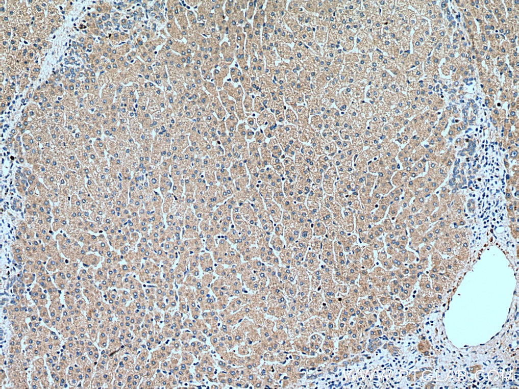 Immunohistochemistry (IHC) staining of human liver tissue using RETN Polyclonal antibody (18170-1-AP)