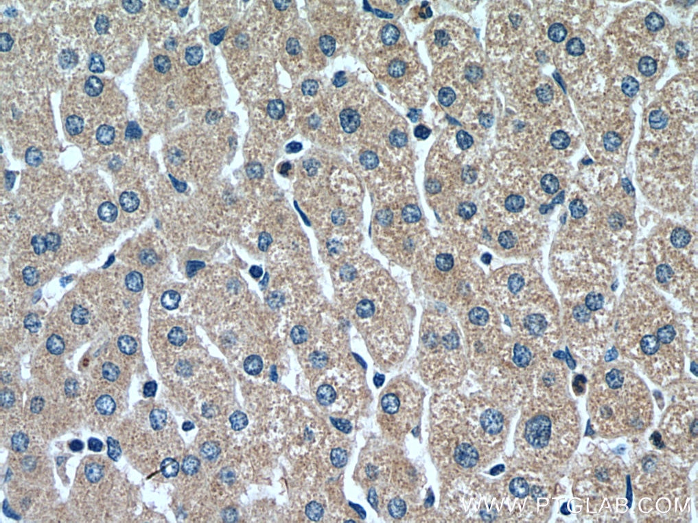 Immunohistochemistry (IHC) staining of human liver tissue using RETN Polyclonal antibody (18170-1-AP)
