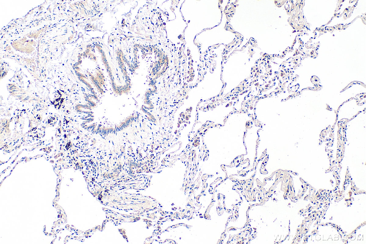 Immunohistochemistry (IHC) staining of human lung tissue using Resistin Polyclonal antibody (18170-1-AP)