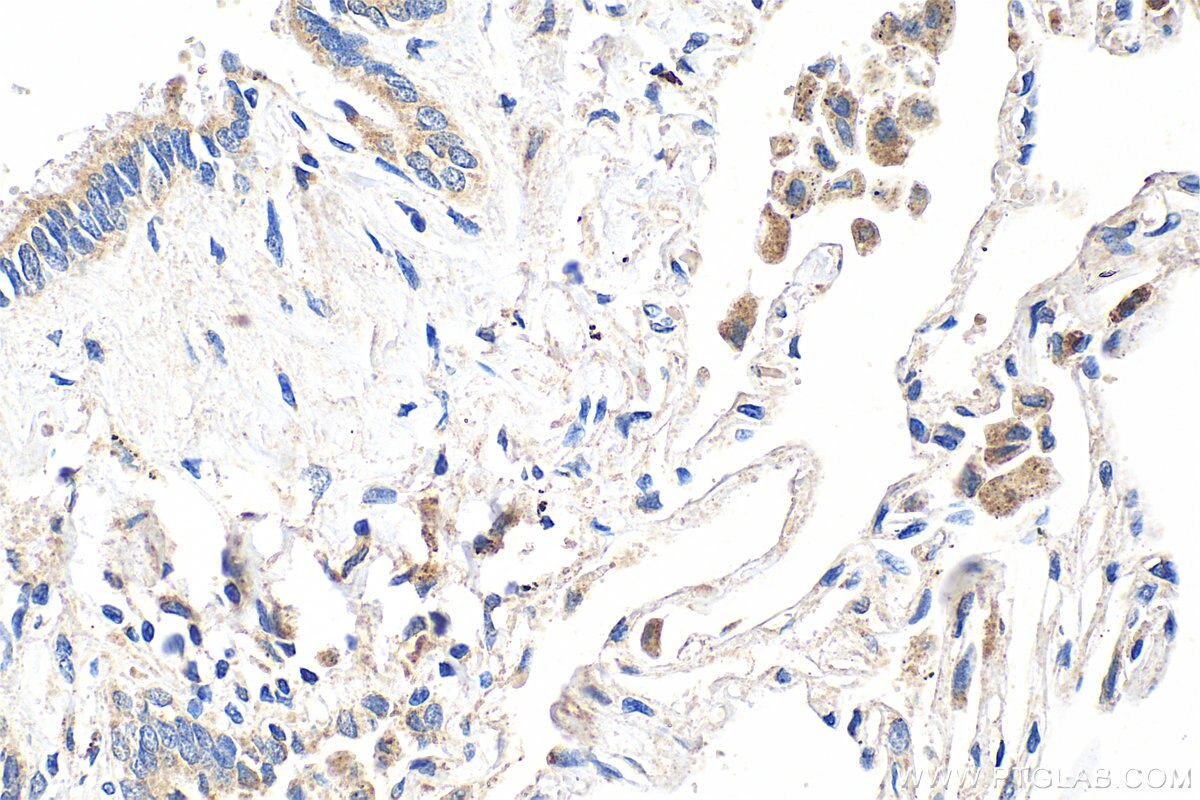 Immunohistochemistry (IHC) staining of human lung tissue using Resistin Polyclonal antibody (18170-1-AP)