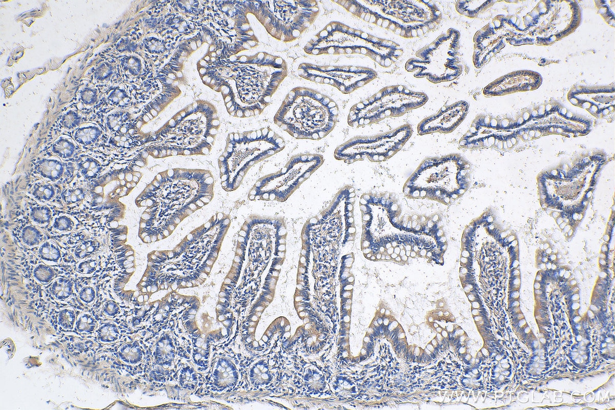 Immunohistochemistry (IHC) staining of human small intestine tissue using RETNLB Polyclonal antibody (18232-1-AP)