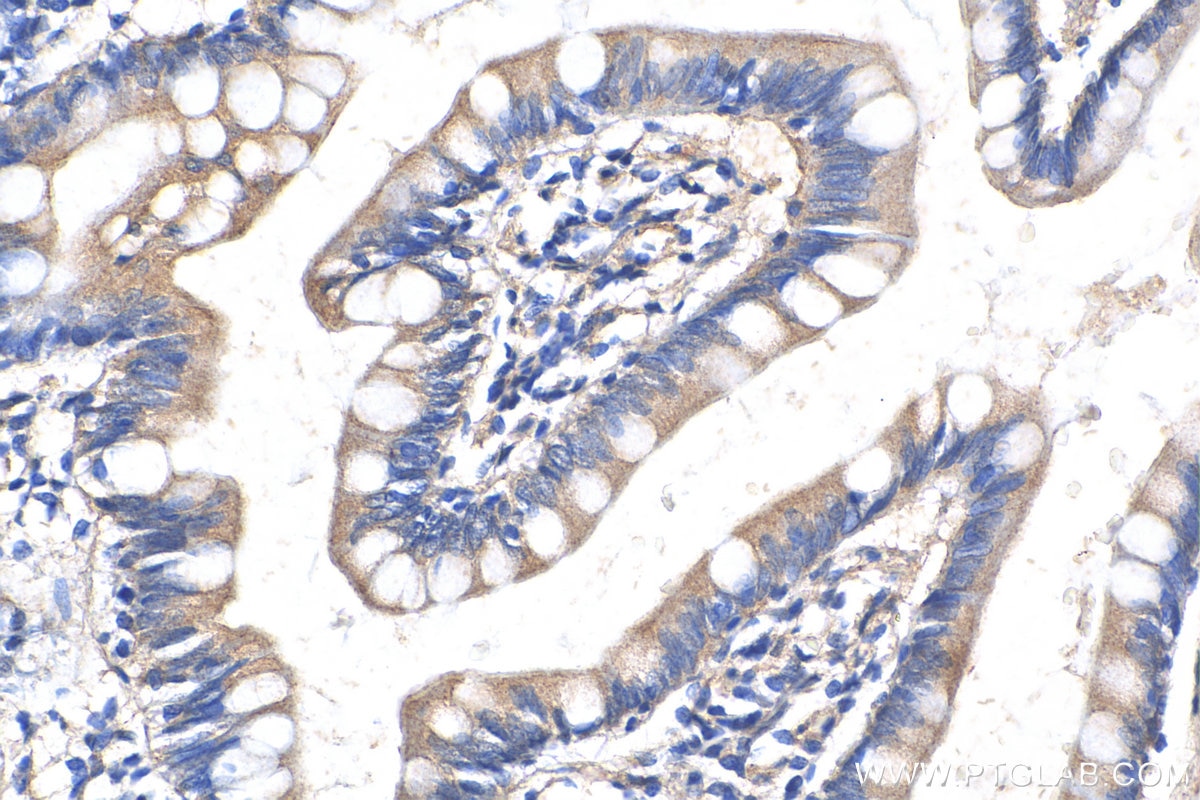 Immunohistochemistry (IHC) staining of human small intestine tissue using RETNLB Polyclonal antibody (18232-1-AP)