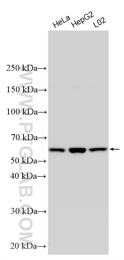 Western Blot (WB) analysis of various lysates using RETSAT Polyclonal antibody (16895-1-AP)