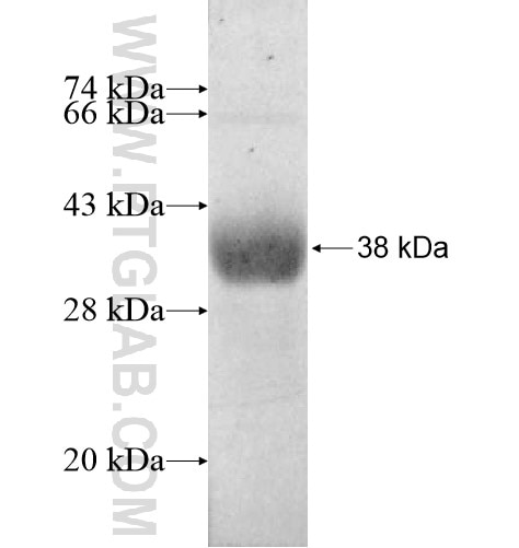 RETSAT fusion protein Ag10866 SDS-PAGE