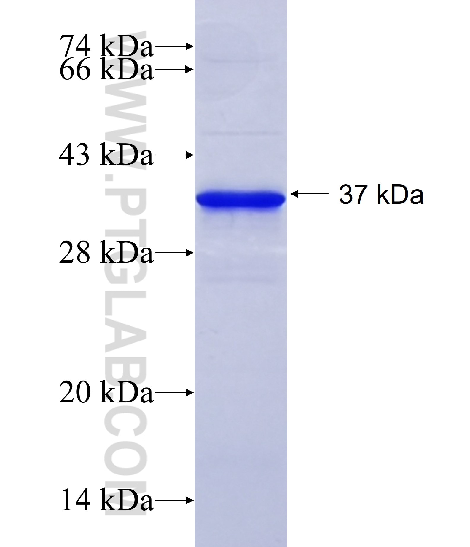 RETSAT fusion protein Ag10866 SDS-PAGE