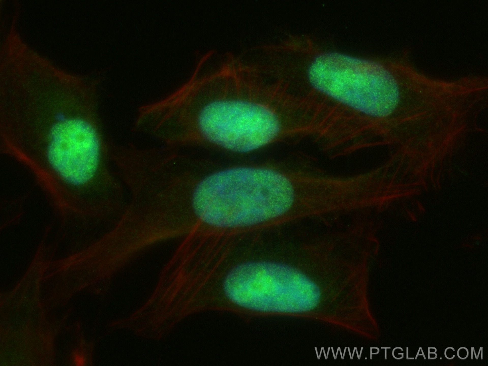 Immunofluorescence (IF) / fluorescent staining of U2OS cells using REV1 Polyclonal antibody (17703-1-AP)