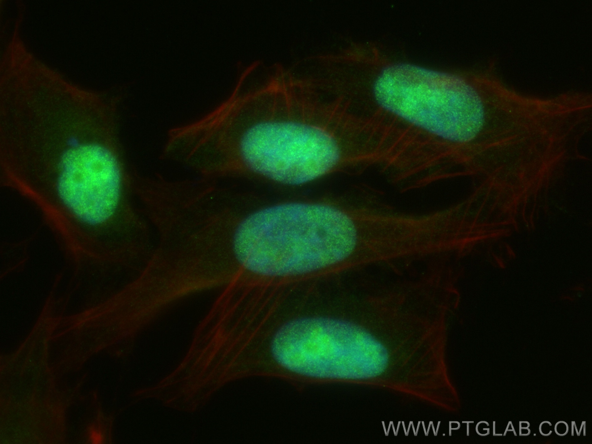 IF Staining of U2OS using 17703-1-AP