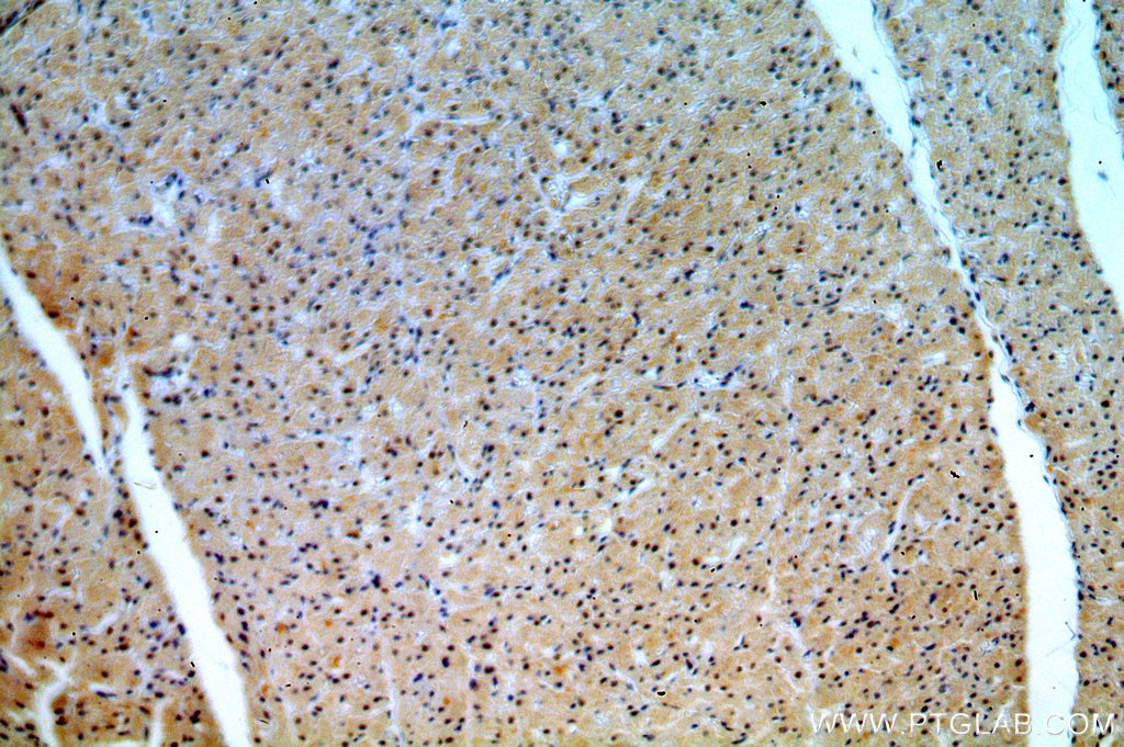 Immunohistochemistry (IHC) staining of human heart tissue using REXO2 Polyclonal antibody (15598-1-AP)