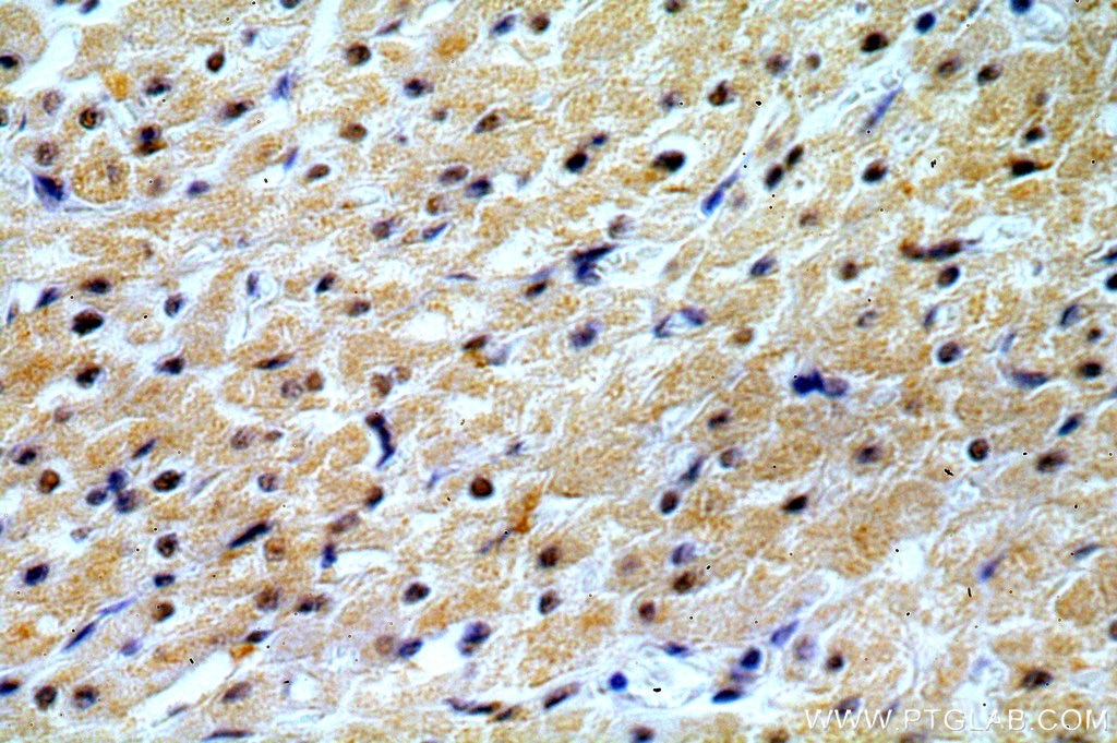 Immunohistochemistry (IHC) staining of human heart tissue using REXO2 Polyclonal antibody (15598-1-AP)