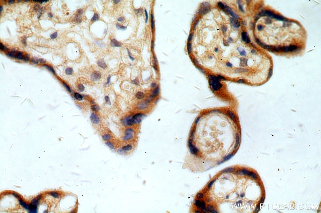 Immunohistochemistry (IHC) staining of human placenta tissue using REXO2 Polyclonal antibody (15598-1-AP)