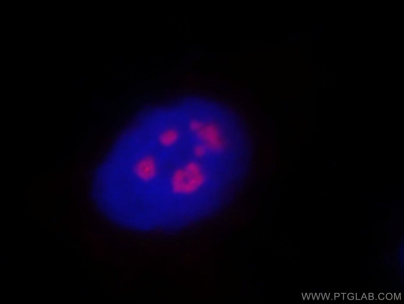 Immunofluorescence (IF) / fluorescent staining of MCF-7 cells using REXO4 Polyclonal antibody (18890-1-AP)