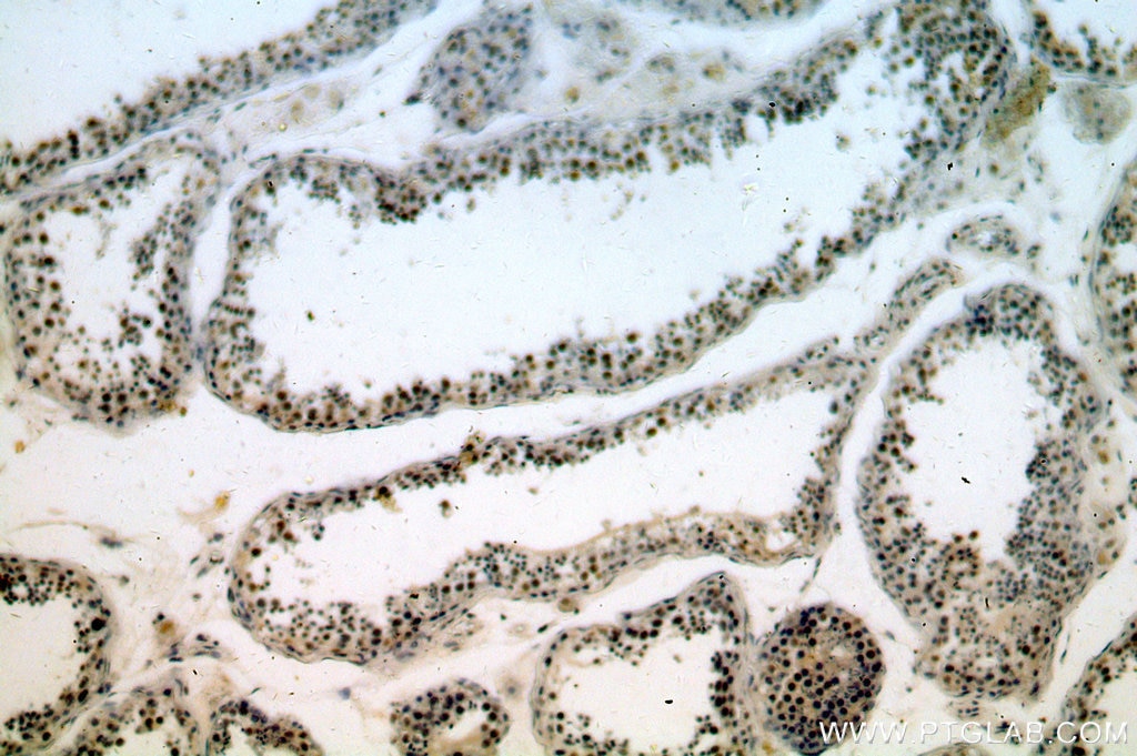 Immunohistochemistry (IHC) staining of human testis tissue using REXO4 Polyclonal antibody (18890-1-AP)