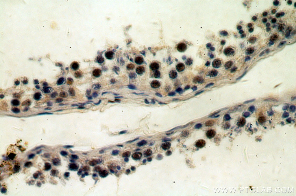 Immunohistochemistry (IHC) staining of human testis tissue using REXO4 Polyclonal antibody (18890-1-AP)