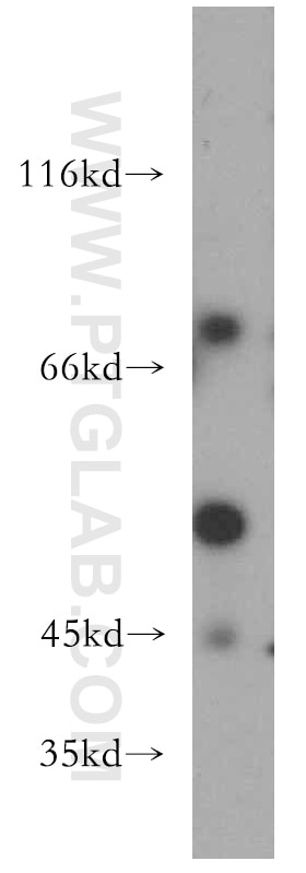 Western Blot (WB) analysis of HeLa cells using REXO4 Polyclonal antibody (18890-1-AP)
