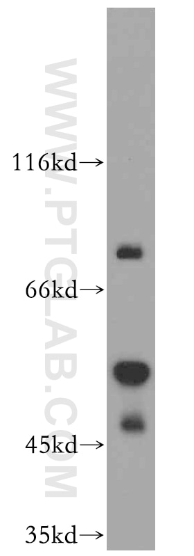Western Blot (WB) analysis of HepG2 cells using REXO4 Polyclonal antibody (18890-1-AP)