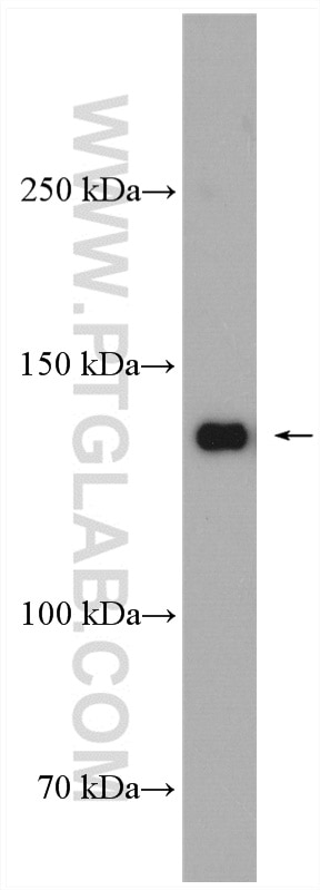 Western Blot (WB) analysis of Jurkat cells using RFC1 Polyclonal antibody (19159-1-AP)