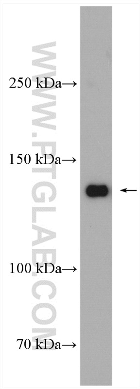 WB analysis of Jurkat using 19159-1-AP
