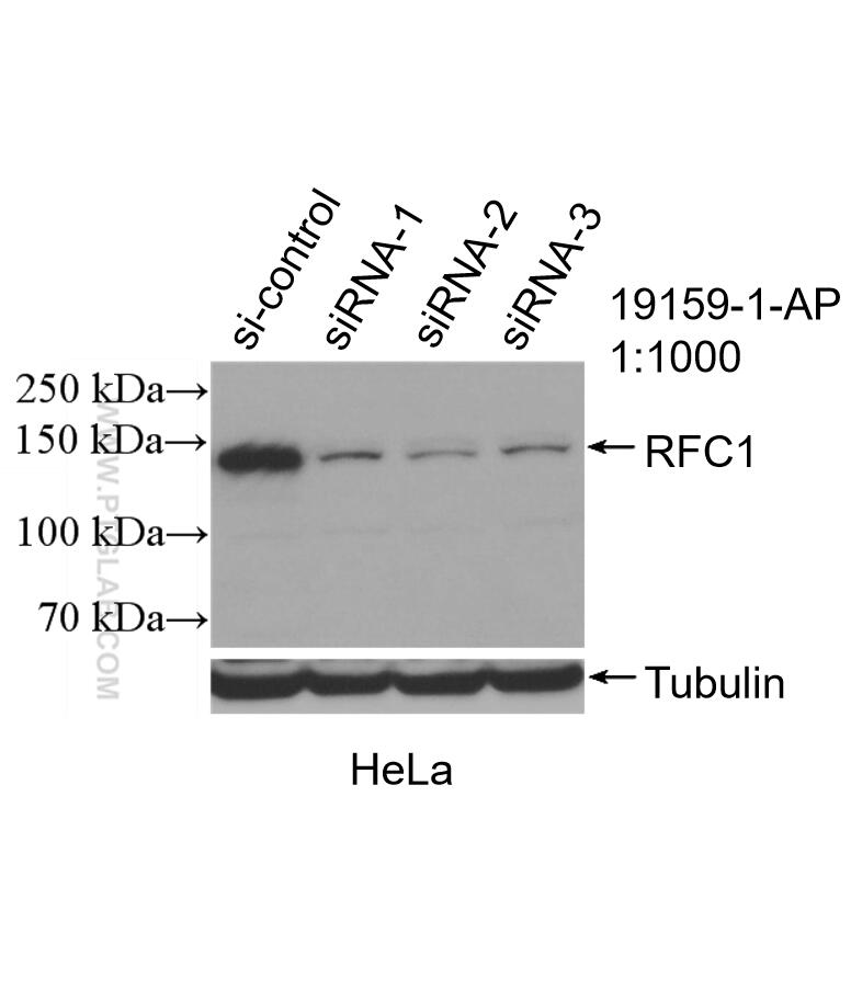 Western Blot (WB) analysis of HeLa cells using RFC1 Polyclonal antibody (19159-1-AP)