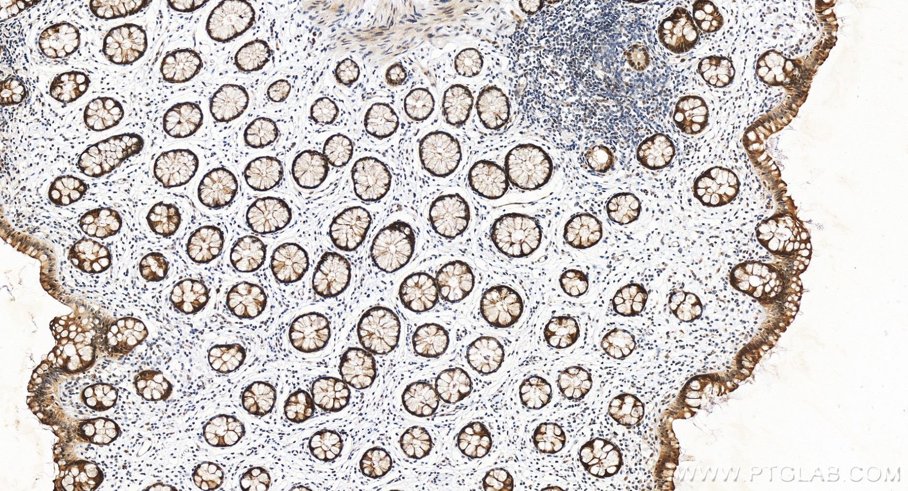 Immunohistochemistry (IHC) staining of human colon tissue using RFC1 Recombinant antibody (85148-4-RR)
