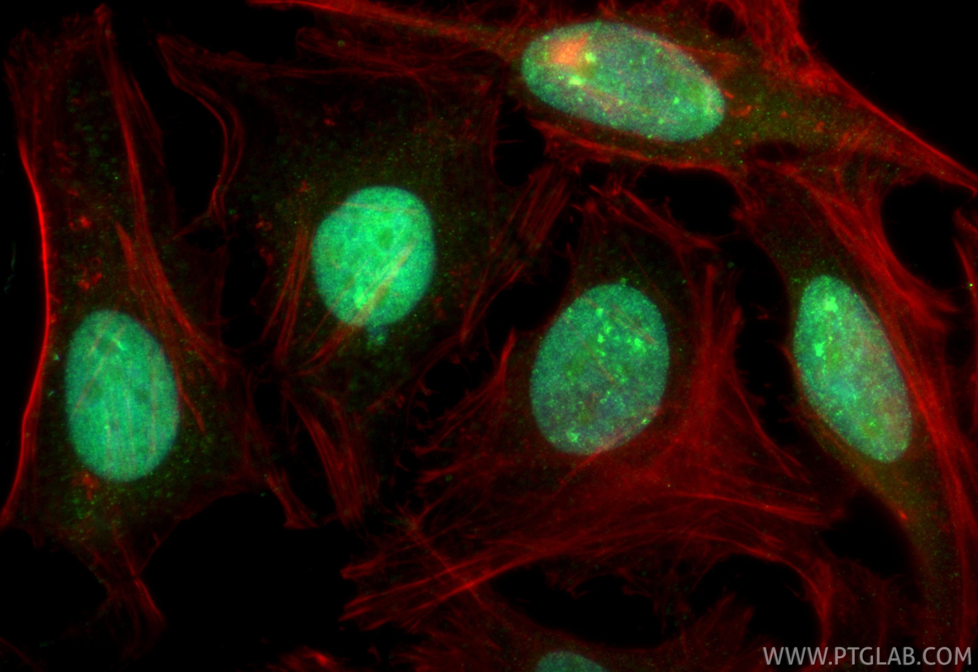 Immunofluorescent analysis of (4% PFA) fixed HeLa cells using CoraLite® Plus 488 RFC1 antibody (CL488-85148-4, Clone: 242818H6 ) at dilution of 1:200, CL594-Phalloidin (red). Immunofluorescence (IF) / fluorescent staining of HeLa cells using CoraLite® Plus 488-conjugated RFC1 Recombinant mon (CL488-85148-4)