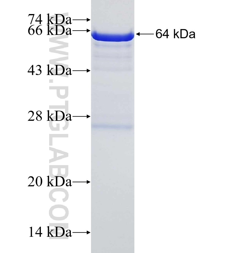 RFC1 fusion protein Ag13585 SDS-PAGE