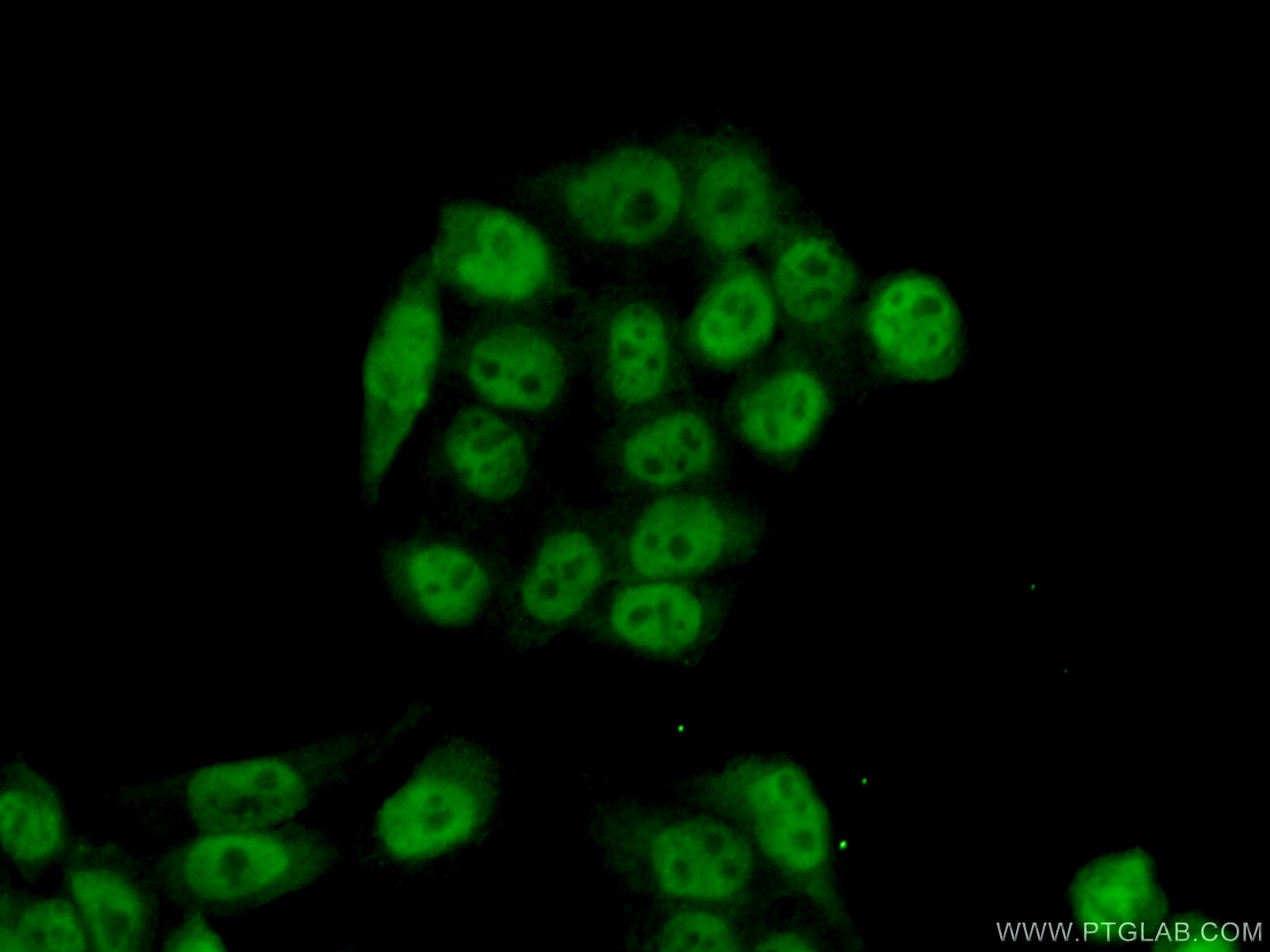 Immunofluorescence (IF) / fluorescent staining of HeLa cells using RFC2 Polyclonal antibody (10410-1-AP)
