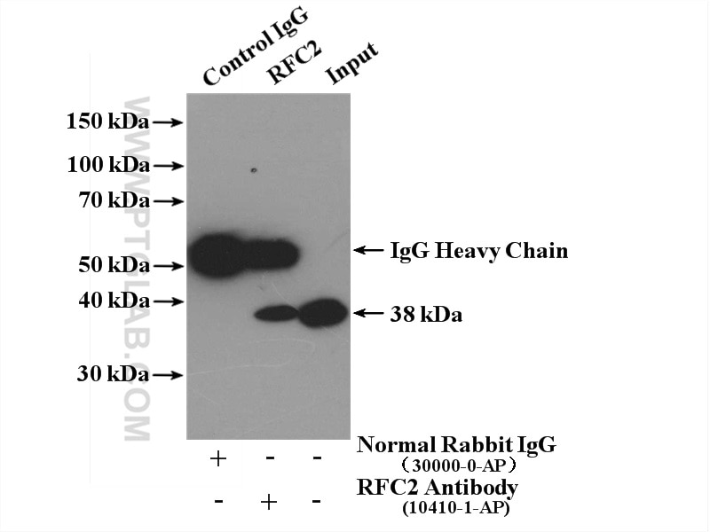 Immunoprecipitation (IP) experiment of HeLa cells using RFC2 Polyclonal antibody (10410-1-AP)