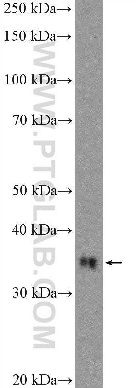 WB analysis of MCF-7 using 10410-1-AP