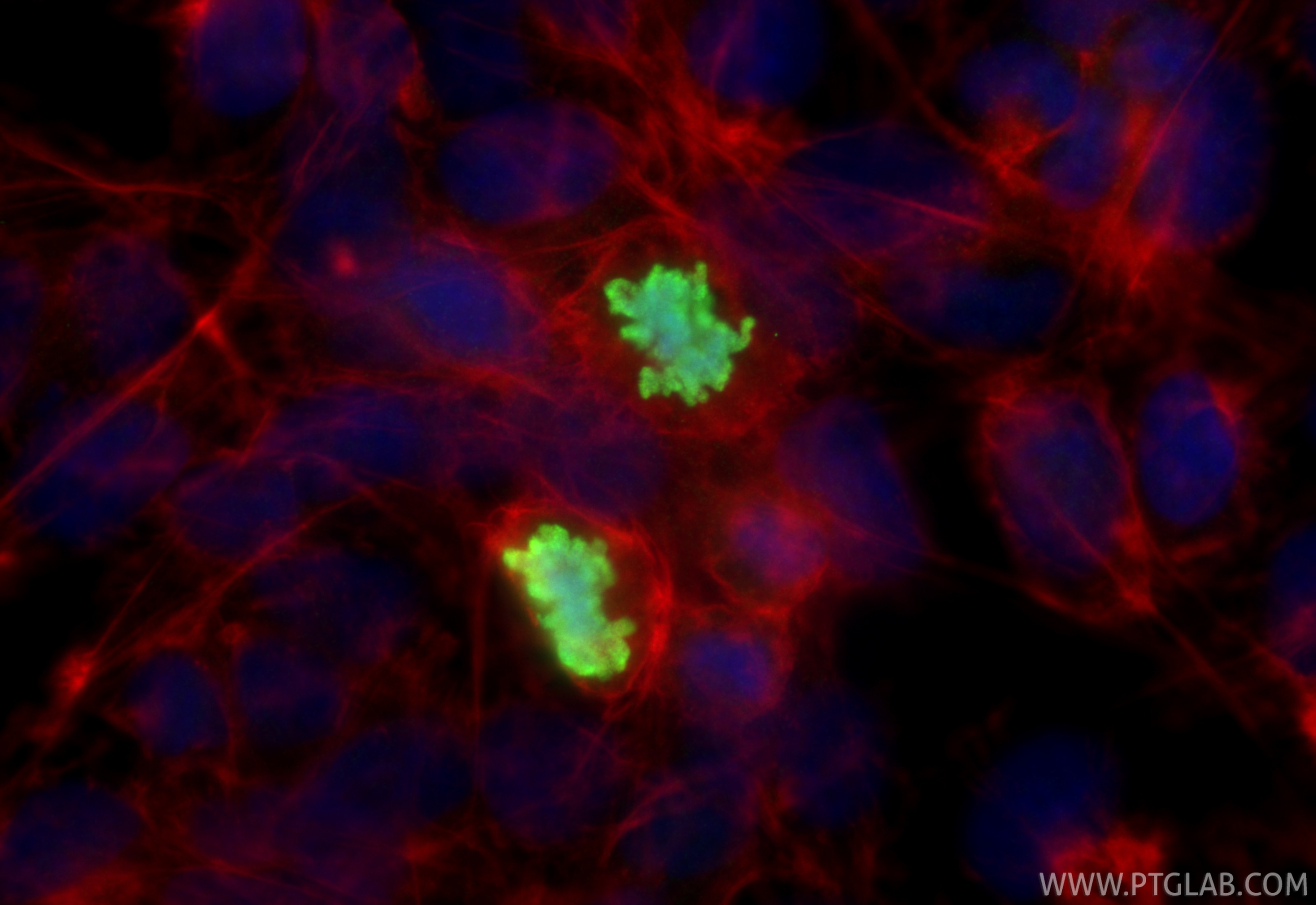 Immunofluorescence (IF) / fluorescent staining of U2OS cells using RFC3 Polyclonal antibody (11814-1-AP)
