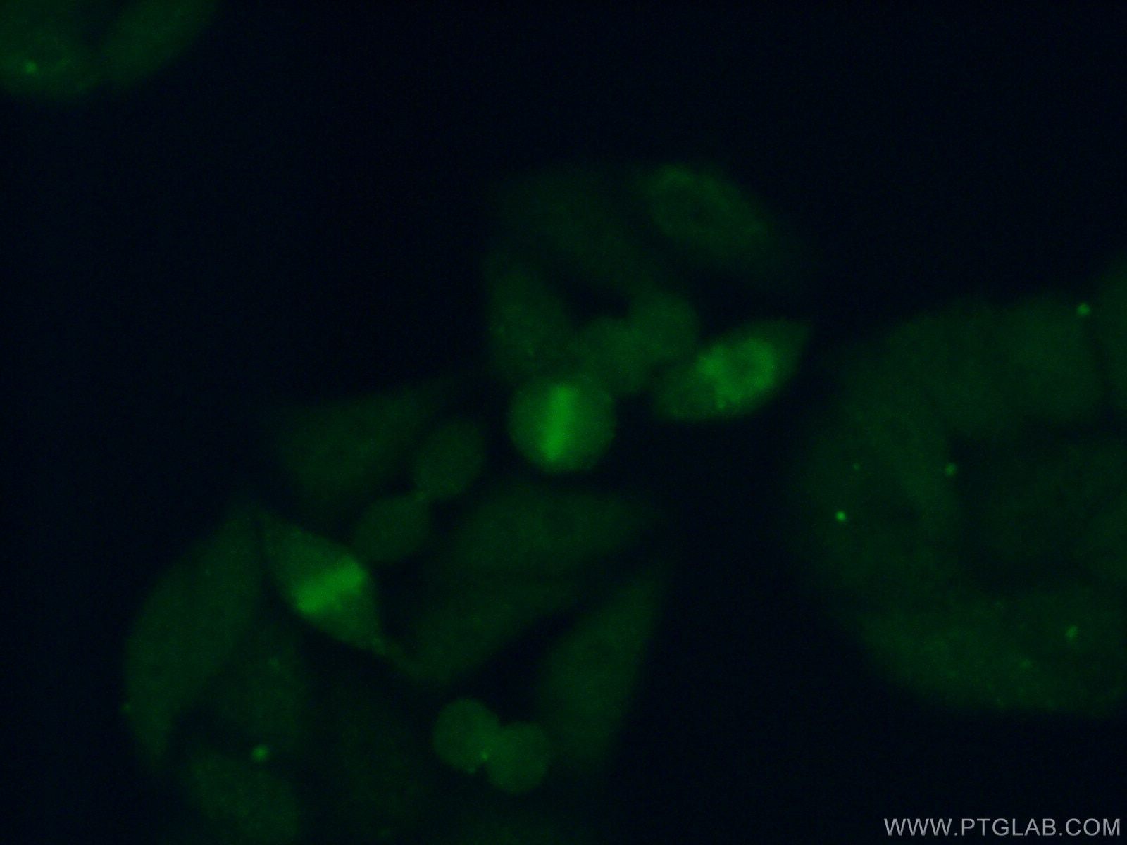 Immunofluorescence (IF) / fluorescent staining of HepG2 cells using RFC3 Polyclonal antibody (11814-1-AP)