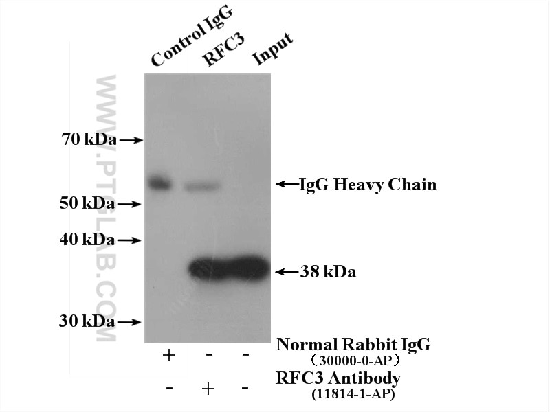 Immunoprecipitation (IP) experiment of HeLa cells using RFC3 Polyclonal antibody (11814-1-AP)