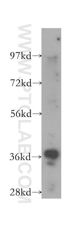 Western Blot (WB) analysis of human heart tissue using RFC3 Polyclonal antibody (11814-1-AP)