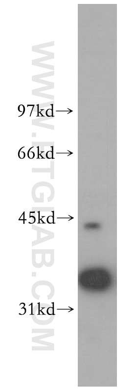 Western Blot (WB) analysis of HeLa cells using RFC3 Polyclonal antibody (11814-1-AP)
