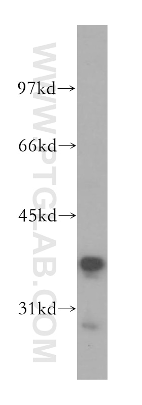 Western Blot (WB) analysis of human liver tissue using RFC3 Polyclonal antibody (11814-1-AP)