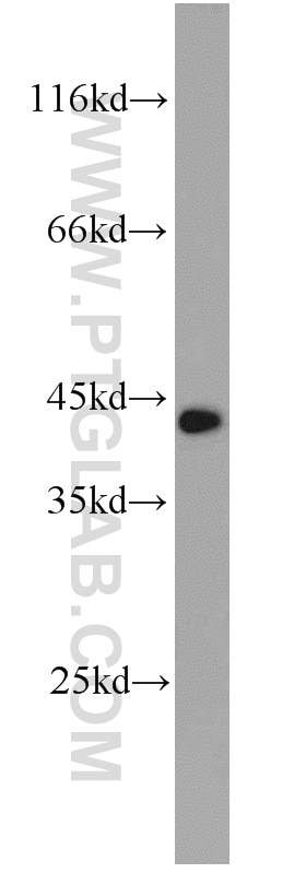 Western Blot (WB) analysis of LNCaP cells using RFC4 Polyclonal antibody (10806-1-AP)