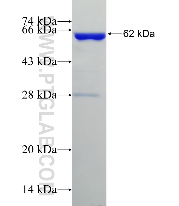 RFC4 fusion protein Ag1234 SDS-PAGE