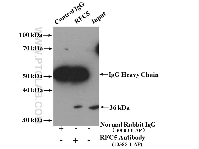 Immunoprecipitation (IP) experiment of HeLa cells using RFC5 Polyclonal antibody (10385-1-AP)