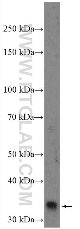 Western Blot (WB) analysis of HeLa cells using RFC5 Polyclonal antibody (10385-1-AP)
