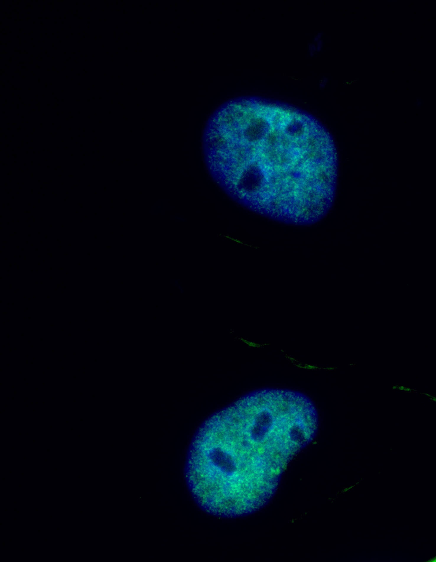 Immunofluorescence (IF) / fluorescent staining of HeLa cells using RFC5 Polyclonal antibody (28671-1-AP)