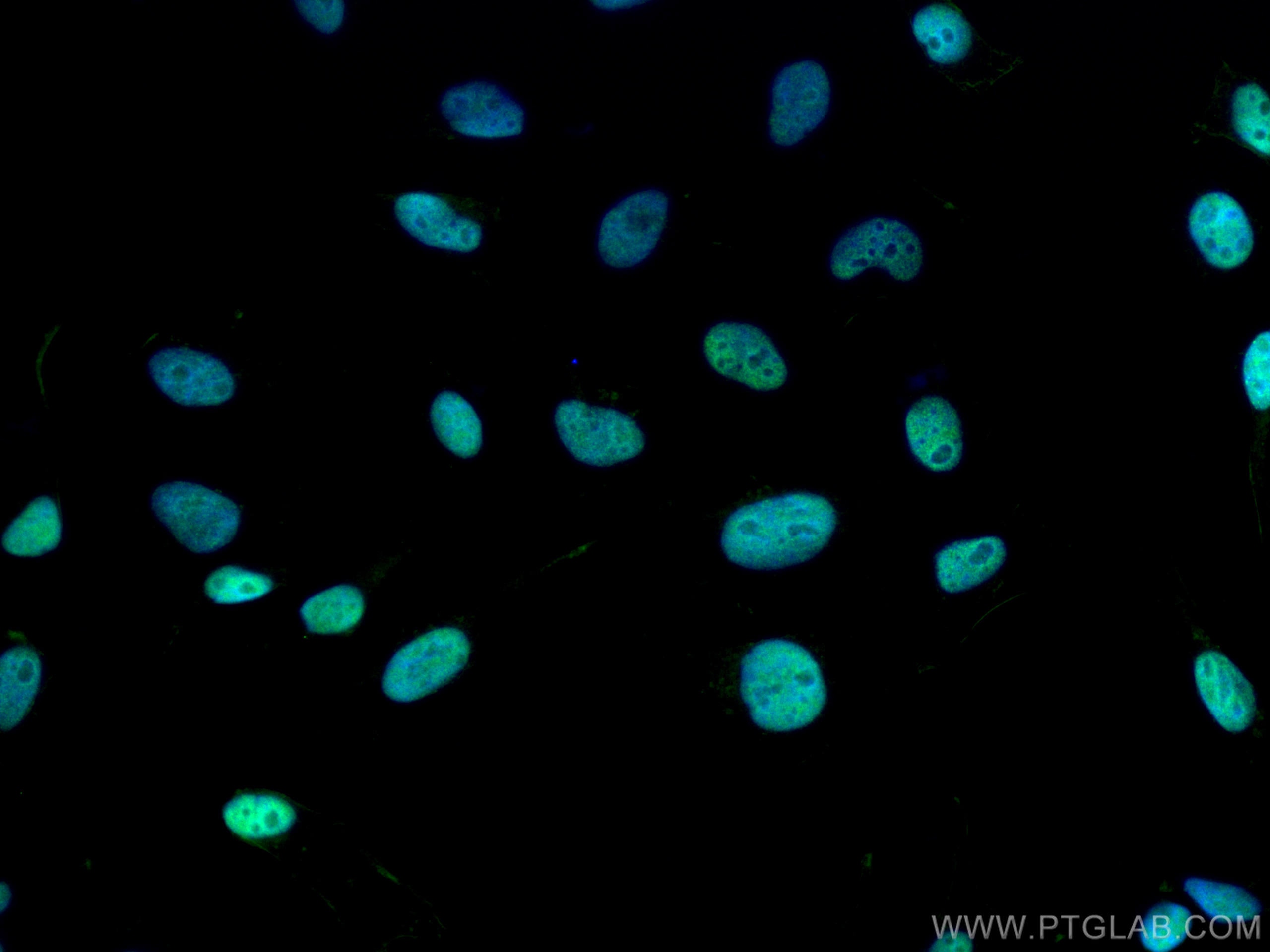 Immunofluorescence (IF) / fluorescent staining of HeLa cells using RFC5 Polyclonal antibody (28671-1-AP)