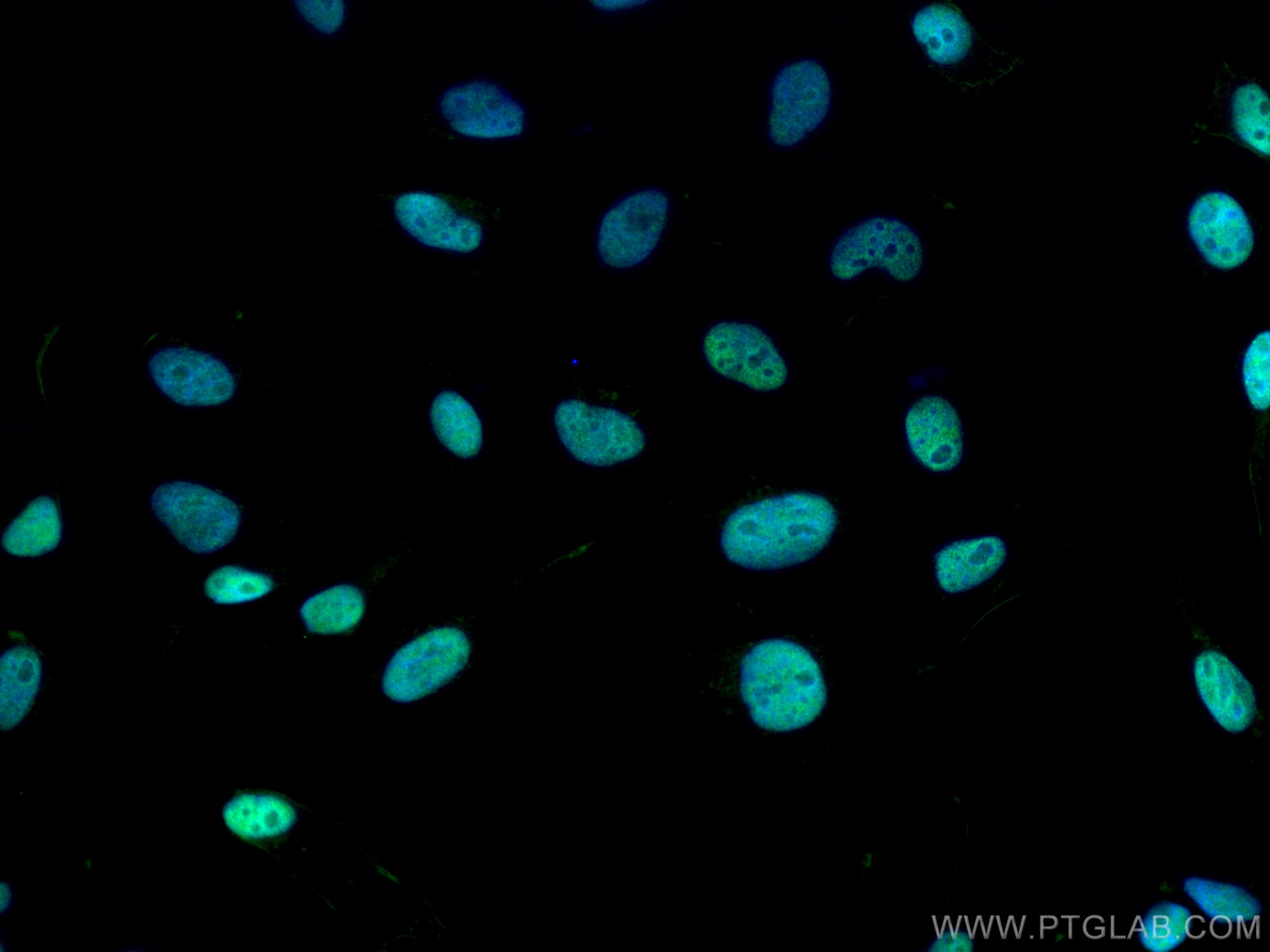 IF Staining of HeLa using 28671-1-AP