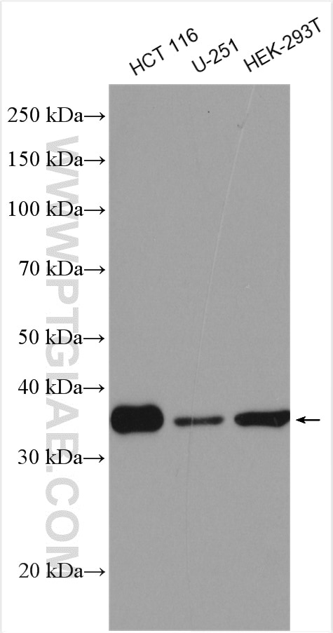Western Blot (WB) analysis of various lysates using RFC5 Polyclonal antibody (28671-1-AP)