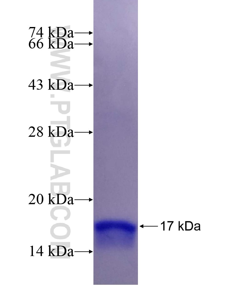 RFC5 fusion protein Ag29236 SDS-PAGE