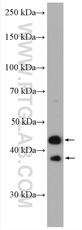 Western Blot (WB) analysis of mouse testis tissue using RFFL Polyclonal antibody (12687-1-AP)