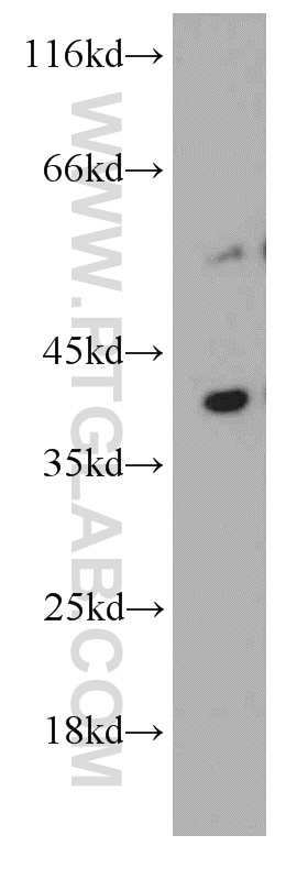 Western Blot (WB) analysis of mouse thymus tissue using RFFL Polyclonal antibody (12687-1-AP)