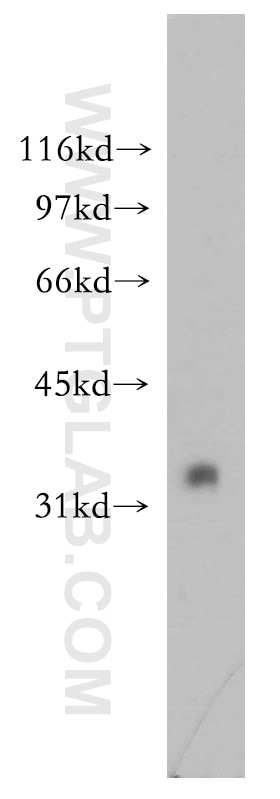 Western Blot (WB) analysis of mouse testis tissue using RFFL Polyclonal antibody (12687-1-AP)
