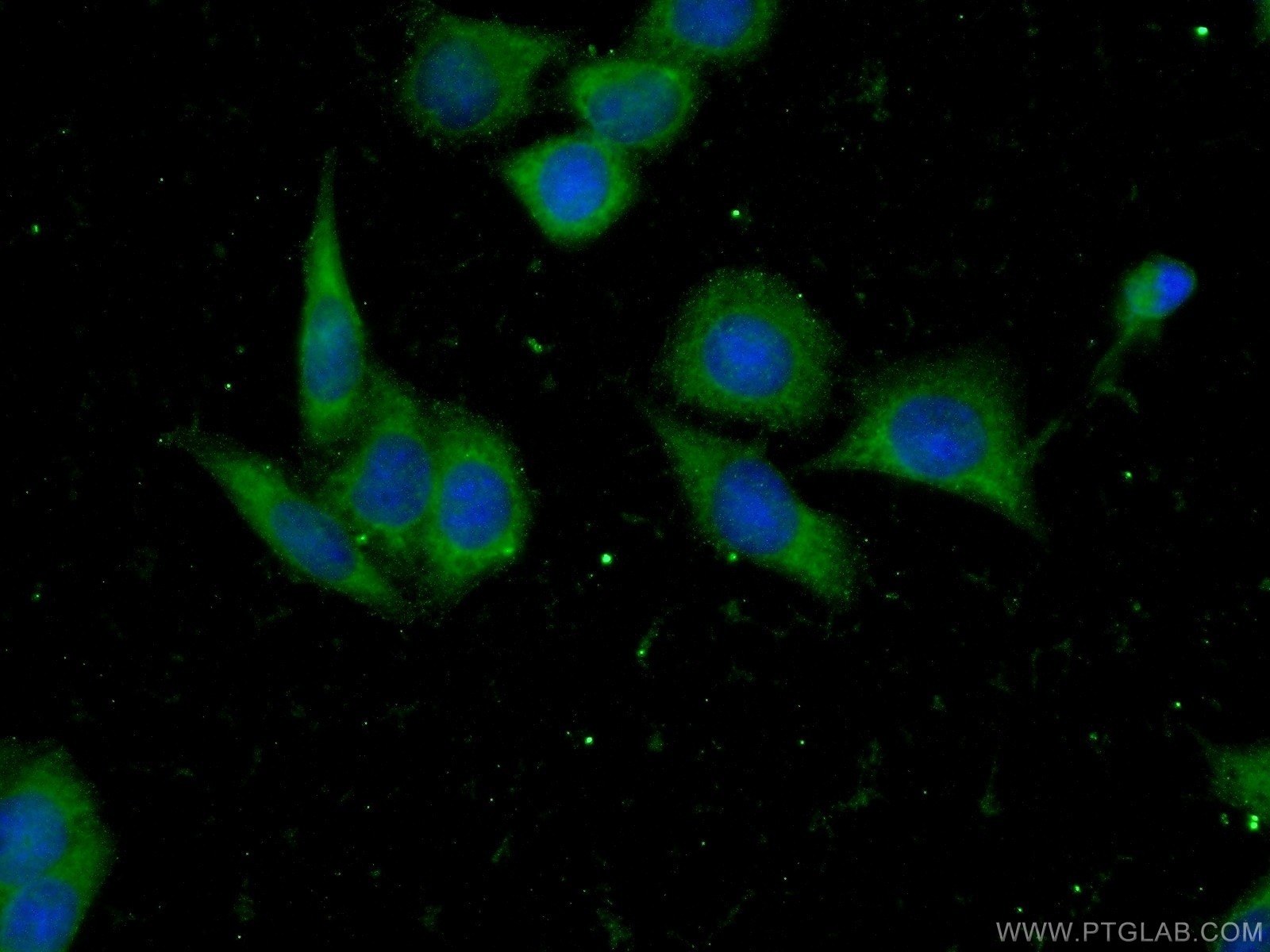 Immunofluorescence (IF) / fluorescent staining of HeLa cells using RFK Polyclonal antibody (15813-1-AP)